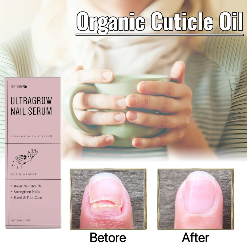  Organic Nail and Cuticle Oil, UltraGrow Nail Serum Natural