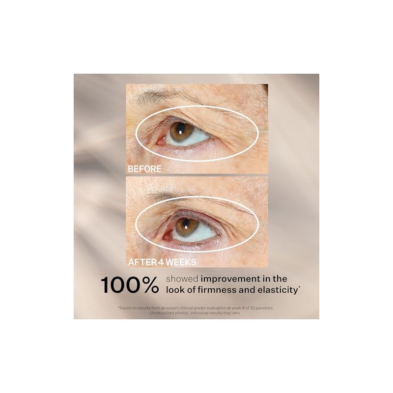 StriVectin Peptight 360˚ Tightening Eye Serum, 1 fl. Oz