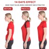 Schiara Posture Corrector for Men and Women, Comfortable Upper and