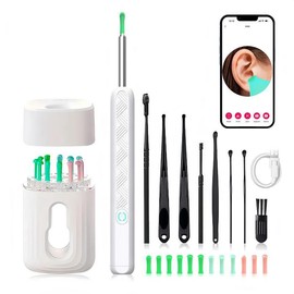 SpringBreak Earwax Removal Tool Set with Camera - Portable 360¬∞ Wide Angle Ear Cleaner with Type-C Rechargeable, Waterproof Endoscope Ear Cleaning Tool for iPhone and Android Phones, Christmas Gift, Winter Gift Set, New Year Gift, Stocking Fillers:_Black-B