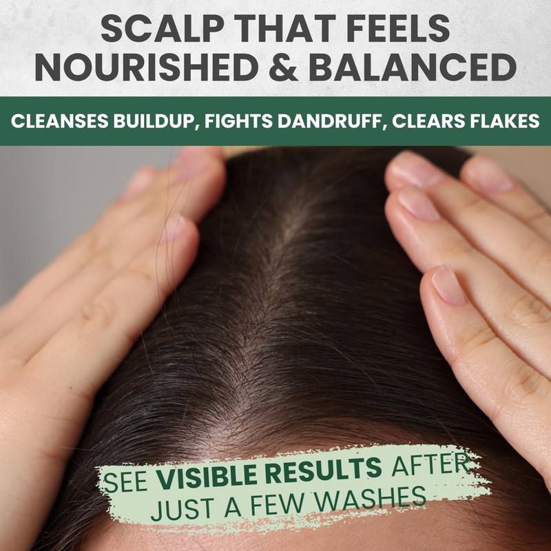 KESMEDIK Tea Tree Oil Shampoo and Conditioner MaxTherapy Set, Itchy