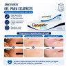 Parches Cuidado Facial Elimina Acné Espinillas Figuras 1016p