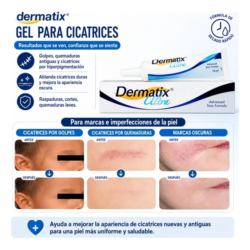 Parches Cuidado Facial Elimina Acné Espinillas Figuras 1016p
