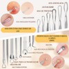16 piezas – Kit de herramientas para eliminar espinillas y
