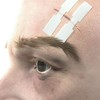 Cutiderm Skin Sterile Butterfly Wound Closure Suture Strips, 2 Sizes