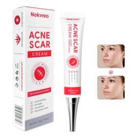 Crema Para El Acné Reduce Granitos Y Mejora La Piel 30g