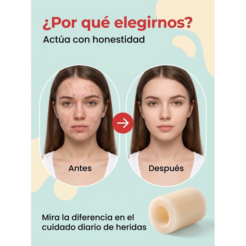 2PCS Cinta Hidrocoloide para el Cuidado de Heridas Hydrocolloid Roll