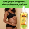Aceite Calmante para Embarazadas Palmer's Cocoa Butter 150ml Importado