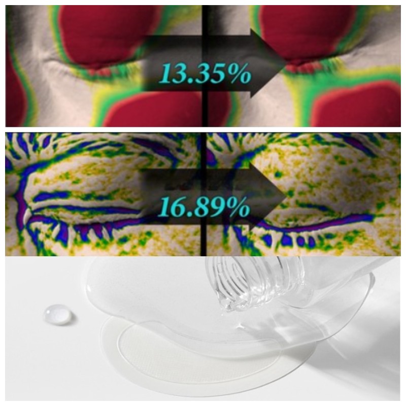 CHARD Eye Bag Lift 1100 Shot Reedle Patch 4pair