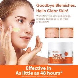 MOOYAM Herbal Acne Removal Cream – 100g Moisturizing Face Gel for Pimples, Oil Control, Shrinking Pores & Clear Skin Care