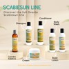OVANTE Scabiesun Multipurpose Cream for Skin Itching, Redness & Irritation