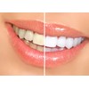 Dr. George's Dental Whitening Gel with Instructions