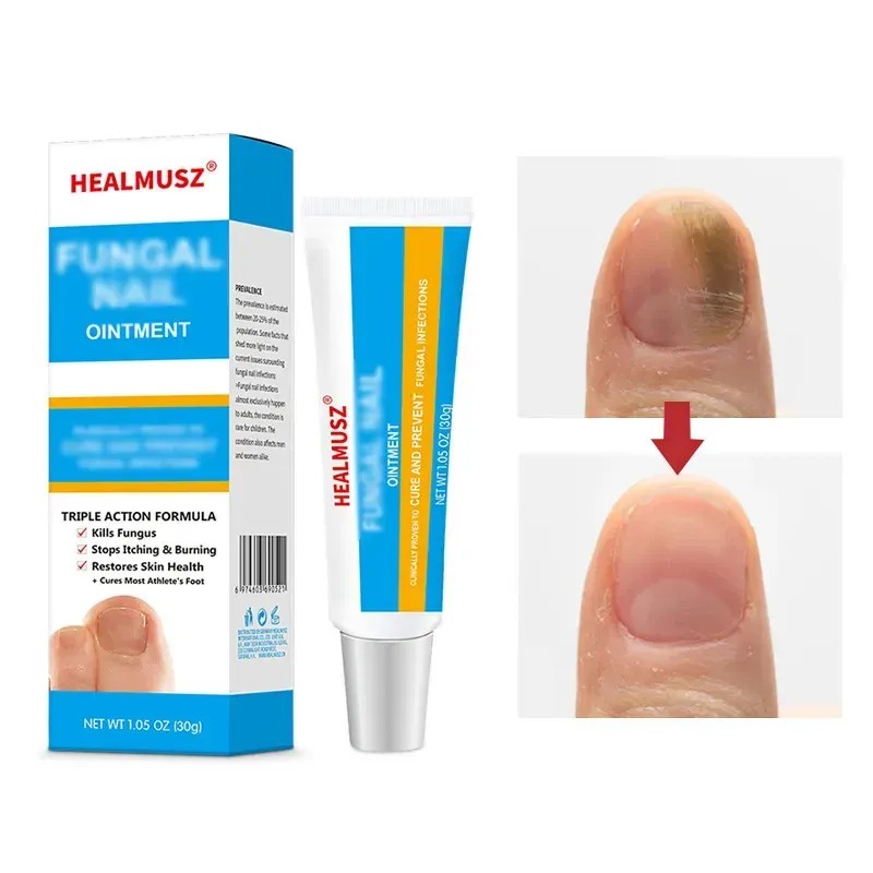 Portable Hand And Foot Nail Care Cream 20g，Crema Multiusos Para
