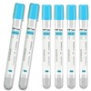 10Pcs 10ml PRP Tubes with ACD and Separation Gel –