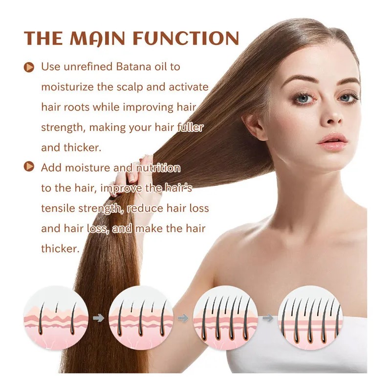 120 Ml Aceite De Crecimiento Del Cabello De Aceite De