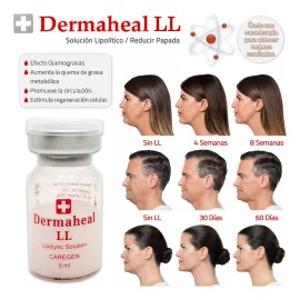 Sérum Lipolítico Dermaheal Ll Reducción De Talla 3 Viales