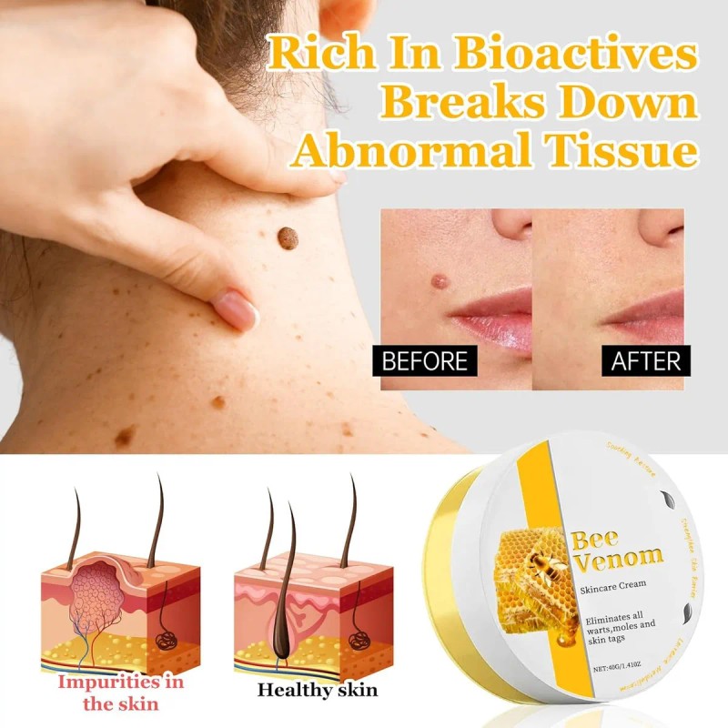 Fg Crema De Lactancia Para La Piel, Eficaz Para Reducir