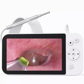 ScopeAround 3.9mm Otoscope Camera Ear Wax Removal inspection camera 1080P HD Video Endoscope