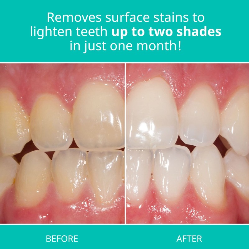 Opalescence Whitening Toothpaste for Sensitive Teeth (2 Pack) - Oral