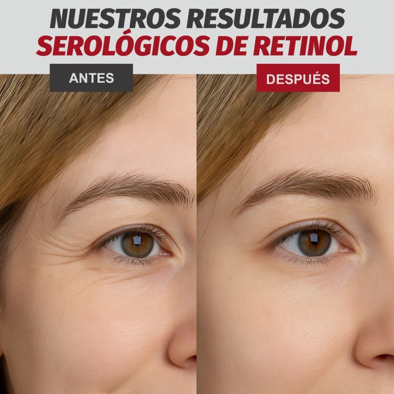 Serum Facial Retinol+vitamina B3+colageno+acido Hialurónico