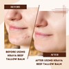 Krava Naturals Beef Tallow for Skin, Beef Tallow for Face,