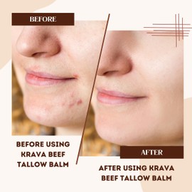 Krava Naturals Beef Tallow for Skin, Beef Tallow for Face, Whipped Tallow Balm, Beef Tallow Moisturizer - Tallow Face Moisturizer, Tallow Cream | 100% Grass Fed, Unscented, 2 oz