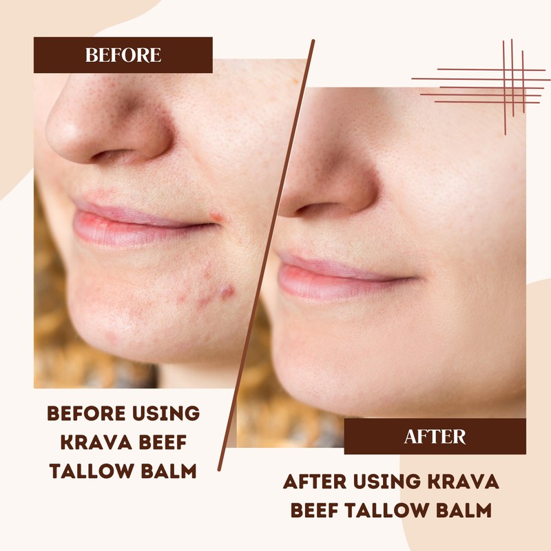 Krava Naturals Beef Tallow for Skin, Beef Tallow for Face,