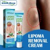 Jx Crema Limpiadora Para Lipomas Nc4c, Bloqueadora Grasa, 1