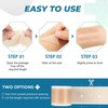 Silicone Scar Sheets, Silicone Scar Tape(1.8”x 157” Roll-4M), Silicone Scar