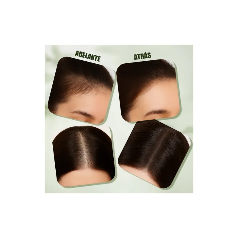 Aceite De Romero Para El Crecimiento Del Cabello 60ml