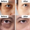 DermaSet Eye Serum with Caffeine and Vitamin C to Improve
