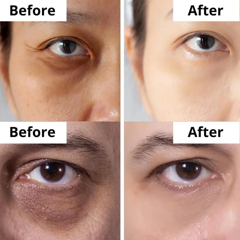 DermaSet Eye Serum with Caffeine and Vitamin C to Improve