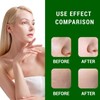 Dark Spot Correcting Glow Serum, Dark Spot Remover for Face