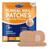 Tratamiento De Hongos En Las Uñas De Los Pies Vigorwell