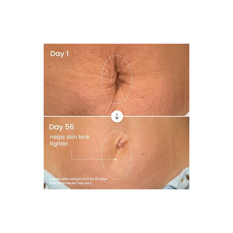 Maelys Cosmetics Women's B-Flat Firming Belly Cream & Moisturizer 7290017683201