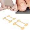 Ingrown toenail tape, painful correction, digging management self protect 7ea
