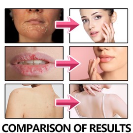 Tkekruh Scrub (2, 20g)