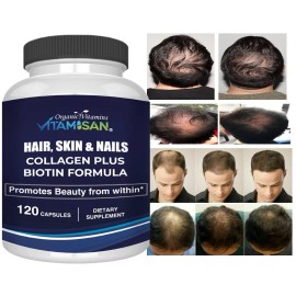 Hair Gain Biotin Hydrolyzed DHT Blocker Hair Growth Vitamins 2500000 Women Men