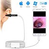 ScopeAround Ear Wax Removal Camera for Android Phone Tablet, Mac, PC, 1280x720HD Smart Visual Ear Cleaner with Camera Tool Kit, at Home Ear Infection Detector Ear Wax Remover Otoscope with Light