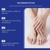 Extra Strength Fungal Nail Patches for Toenails & Fingernails, 32