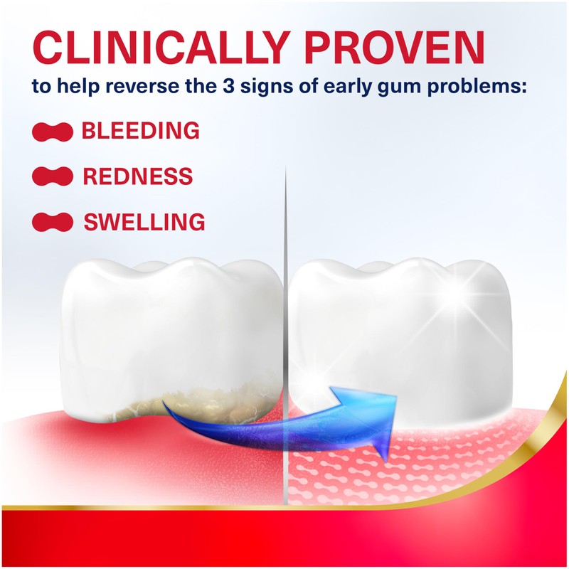 Parodontax Active Gum Repair Toothpaste, Toothpaste To Help Reverse Signs