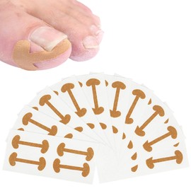 Pack of 40 Ingrown Toenails, Toenail Correction, Ingrown Toenail, Nail Clip, Ingrown Toenail Stickers, for Ingrown Toenails and Nail Clips