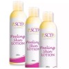 SCD Skin Peeling Lotion 100ml. 1 Bottle (Louise Beauty Box