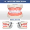 Ultrassist Typodont - Modelo de dientes con 28 dientes extraíbles,
