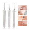 BEAUTÉ GALLERIA Curved Tweezers Blackhead Remover Pimple Extractor Popper Acne