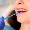 Kit de cuidado bucal de ortodoncia 6 en 1 con