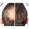 Brains & Son Streuhaar - Premium Haarverdichtung / Schütthaar mit