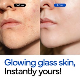 IVOSKIN Rice Milky Foam Bubble Toner I Trouble Care, Hydrating, Glowing Skin, Sensitive Skin, Calming Skin I with Niacinamide & Rice Extract (5.07fl.oz / 150ml)