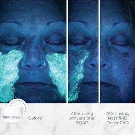 Nasif MD exfoliation pad |Deep Cleansing Surgeon-Crafted AHABHA Facial for Smooth Texture and Glowing Skin Reduce Pore Corporate Whitening Effect Original Formula- Face / 나시프엠디 각질 제거 패드 | 깊은 클렌징 부드러운 텍스처 및 빛나는 피부를 위한 외과의사가 만든 AHABHA 페이셜 모공 기업 미백 효과 감소 Original Formula- Face