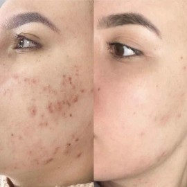 Crema Revitalizadora De Noche Todo Tipo De Piel Noche
